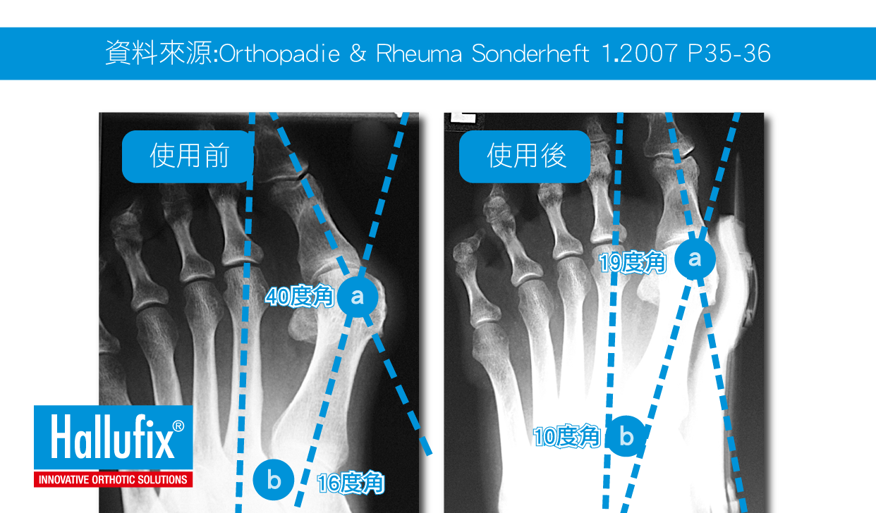 醫療器材輸入許可證 醫療器材輸入許可證